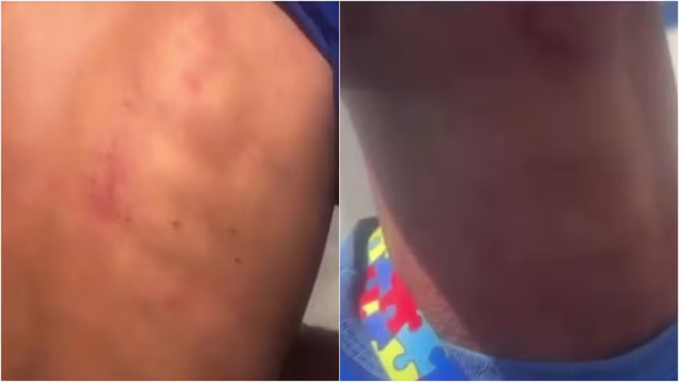 PM afasta policiais após abordagem a jovem autista em Macau